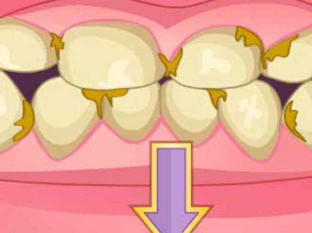Гра: Трансформація хворих зубів